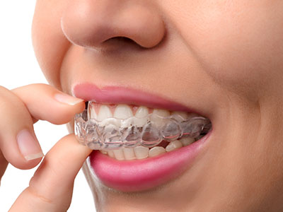 An adult female with a clear smile, holding a transparent dental retainer in her hand.