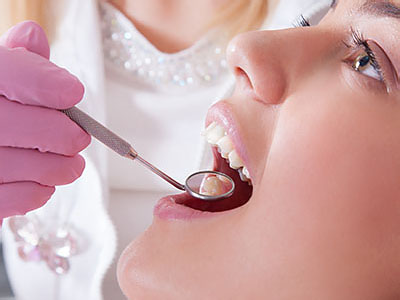 A dental professional performing a procedure on a patient s teeth, using a dental drill and a dental mirror.