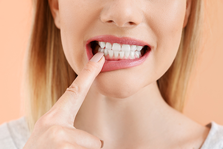 Fine Dental